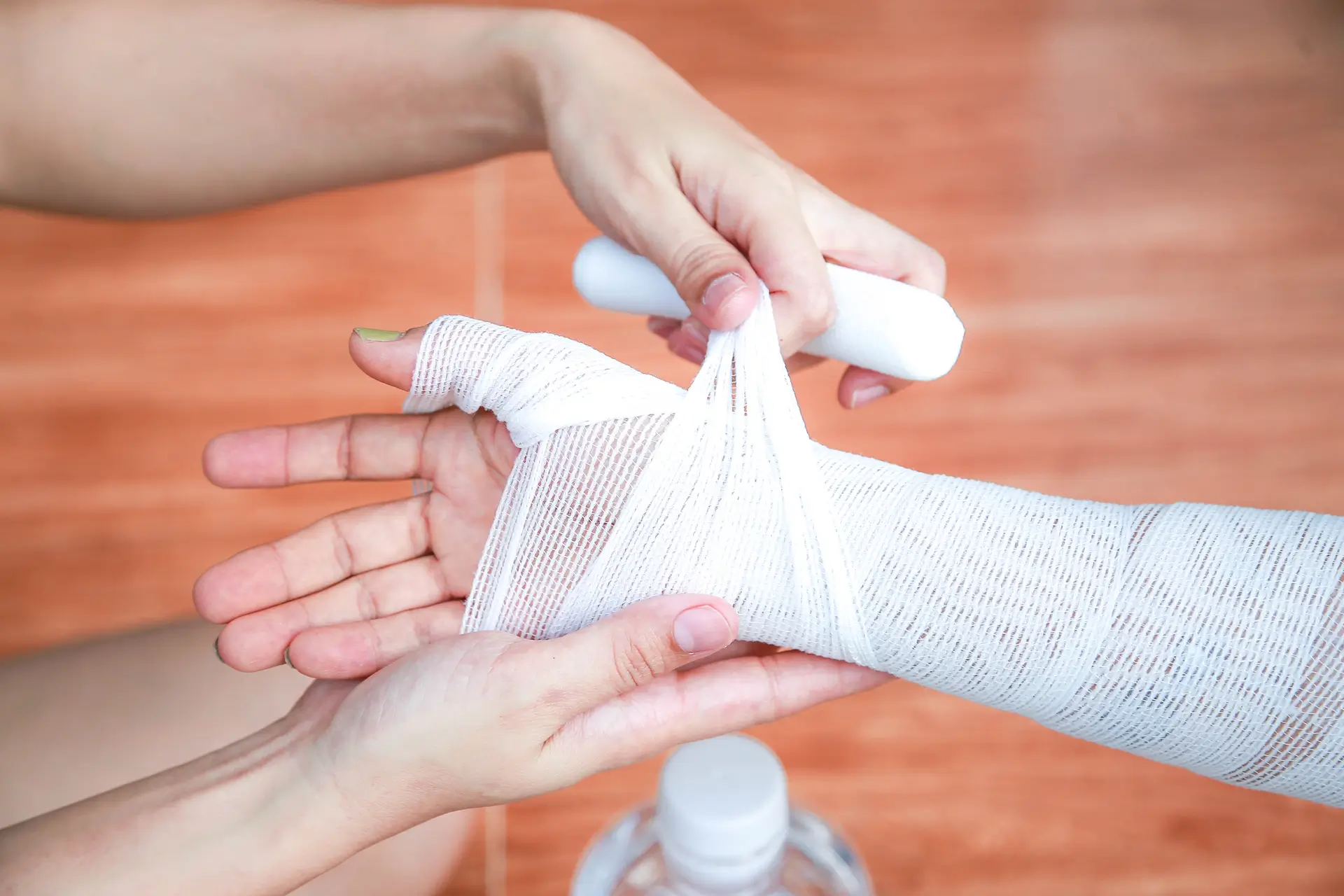 hand being wrapped in Gauss from burn injury